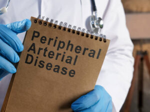 icd 9 code for peripheral vascular disease unspecified