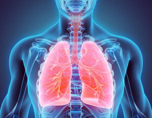 fibrotic interstitial lung disease icd 10